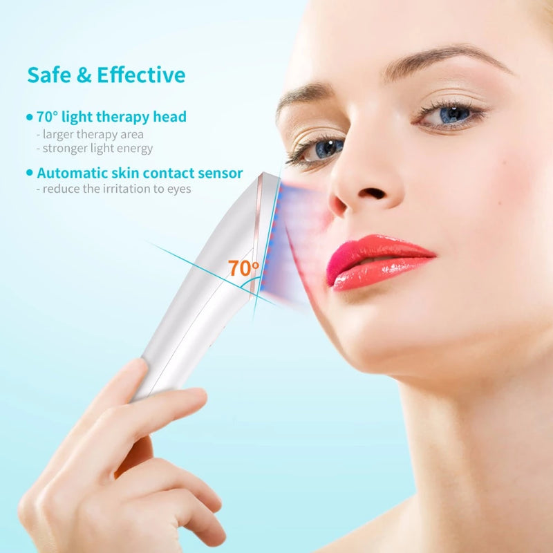 Acne Light Therapy Xpreen Wireless Rechargeable Light Acne Treatment Device