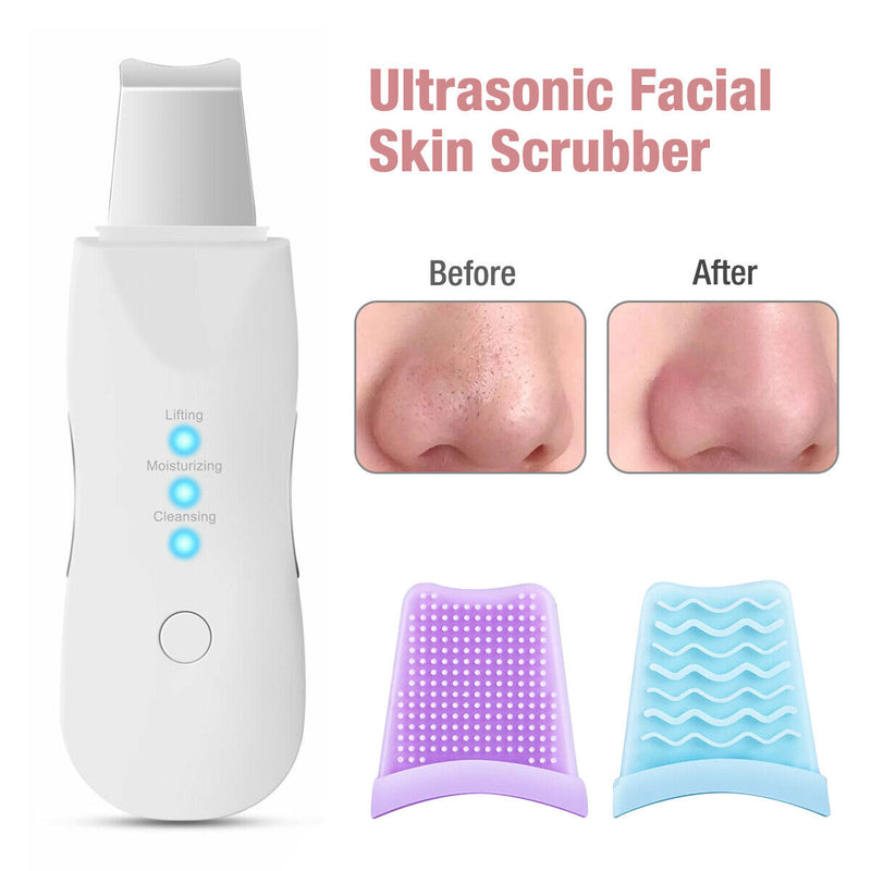 Ultrasonic Skin Scrubber Deep Face Cleaning Machine Peeling Shovel Facial Pore Cleaner Face Skin Scrubber