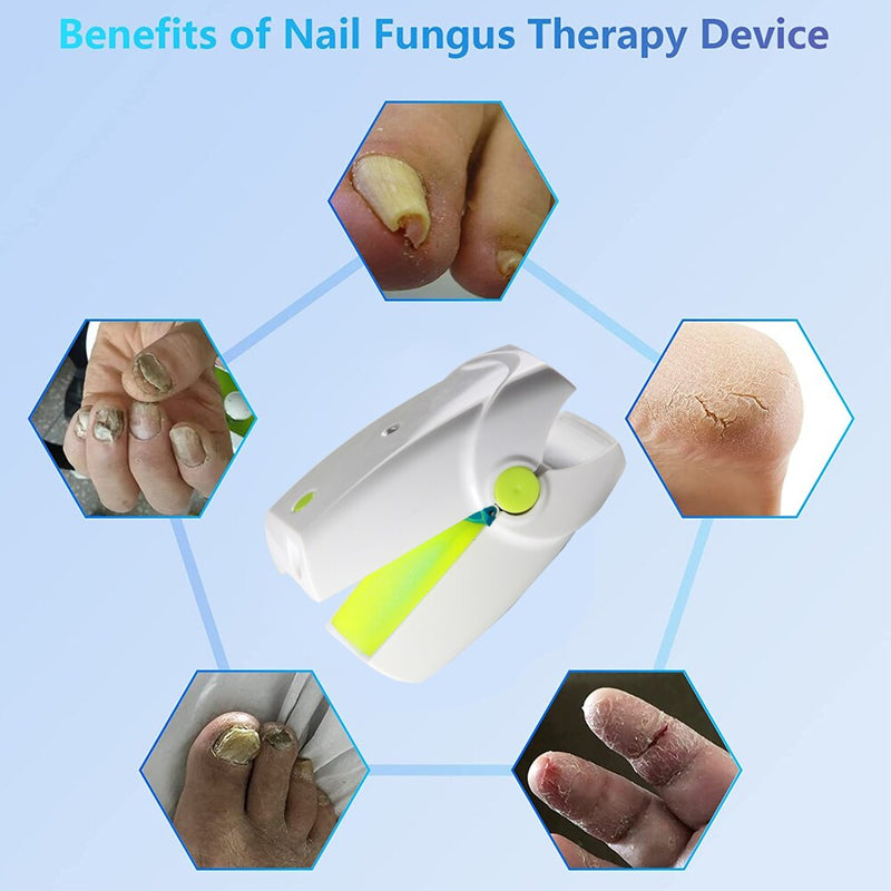 Nail Fungus Laser Nail Treatments Device