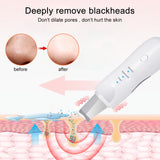 Ultrasonic Skin Scrubber Deep Face Cleaning Machine Peeling Shovel Facial Pore Cleaner Face Skin Scrubber