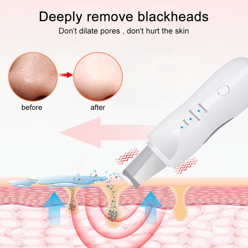 Ultrasonic Skin Scrubber Deep Face Cleaning Machine Peeling Shovel Facial Pore Cleaner Face Skin Scrubber